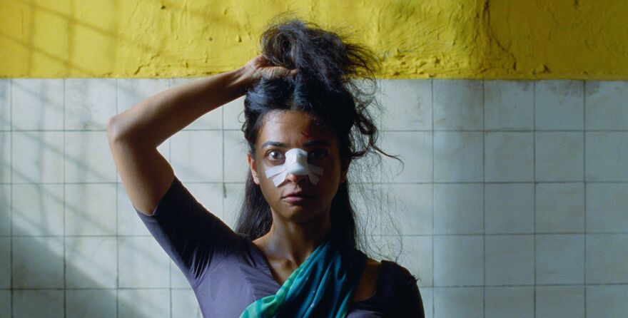 A young woman looks to camera with a bandaged nose. She holds her hair up. 